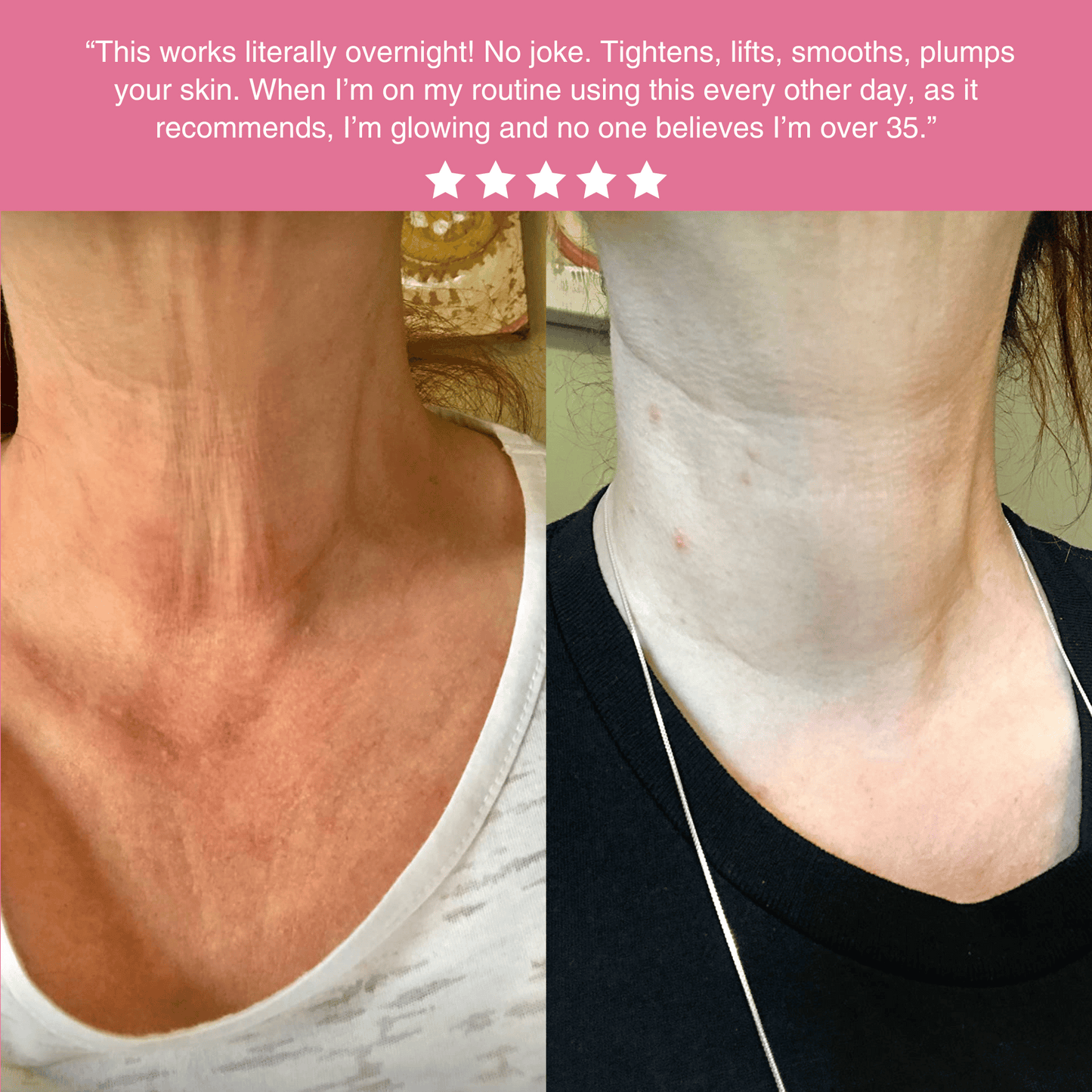 Medical-Grade Silicone Scar Sheets